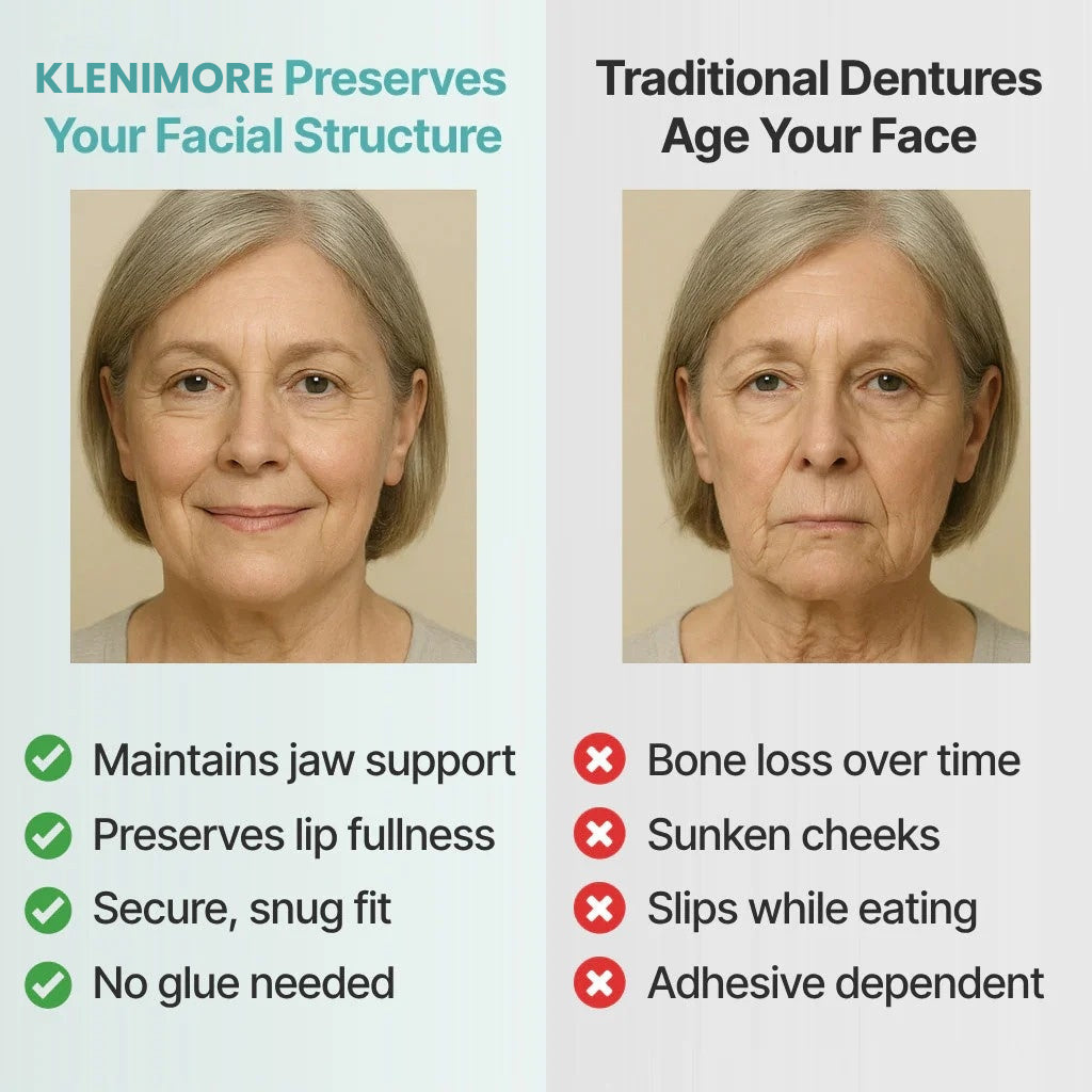 KLENIMOREโข - A Perfect Natural Smile Instantly- UP TO 50% OFF