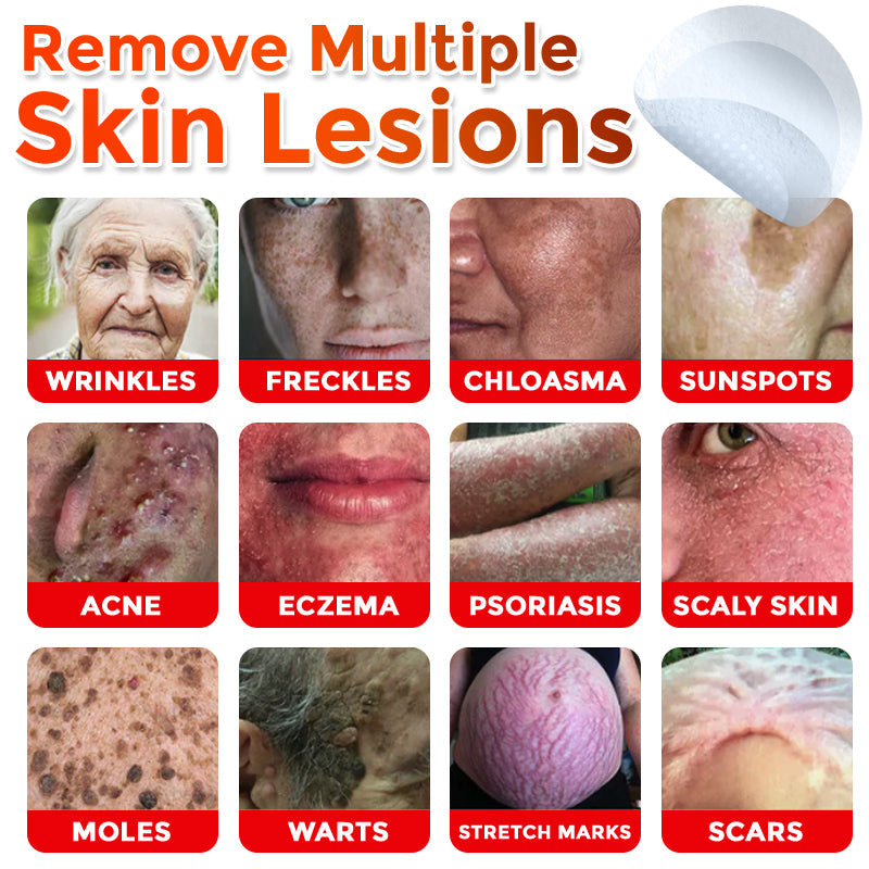 The DermaPoint Patch - Skin Tags Gone in Days, Guaranteed - 50% OFF