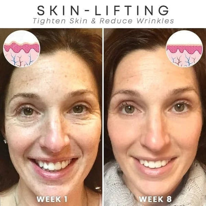 The NeuroTox Serum - The Needle-Free Wrinkle Solution - 50% OFF