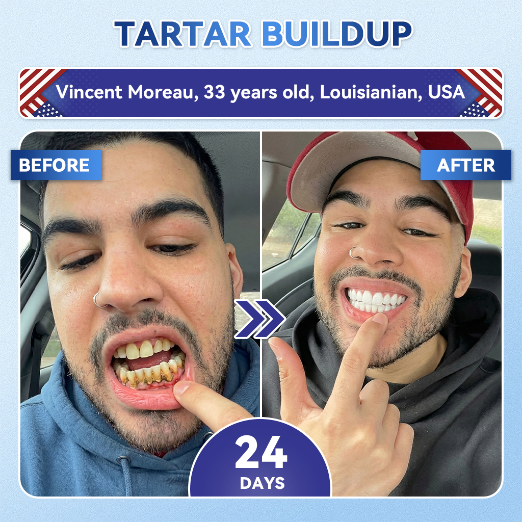 The AuraMints Oral Care Strips — Support a Fresher, Cleaner Smile +  Buy 1 GET 1 FREE