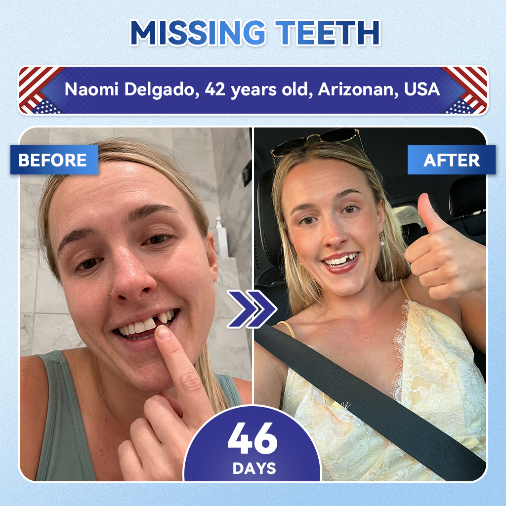 The AuraMints Oral Care Strips — Support a Fresher, Cleaner Smile +  Buy 1 GET 1 FREE