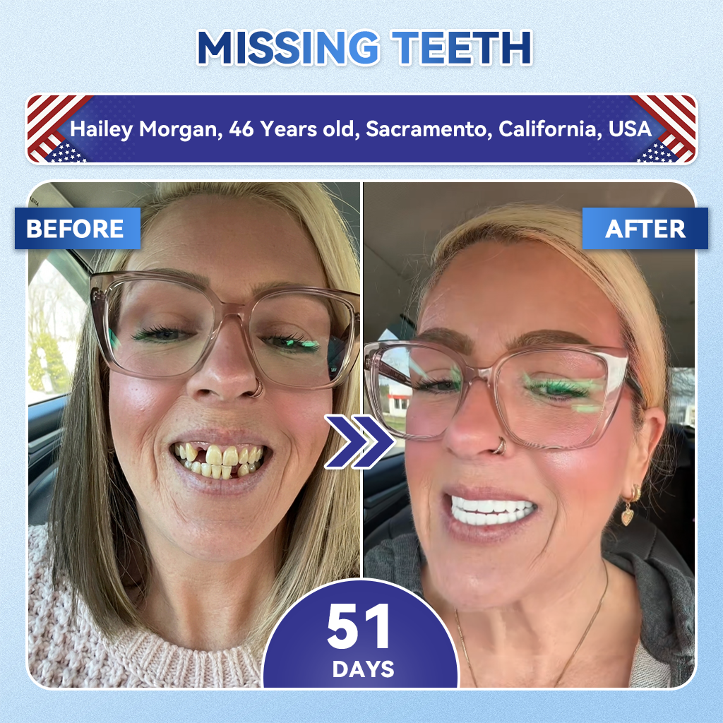 The AuraMints Oral Care Strips — Support a Fresher, Cleaner Smile +  Buy 1 GET 1 FREE