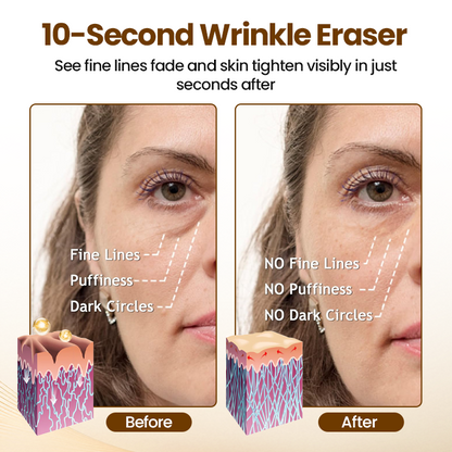 Lift10 - Erase Wrinkles in 10 Seconds + 50% OFF