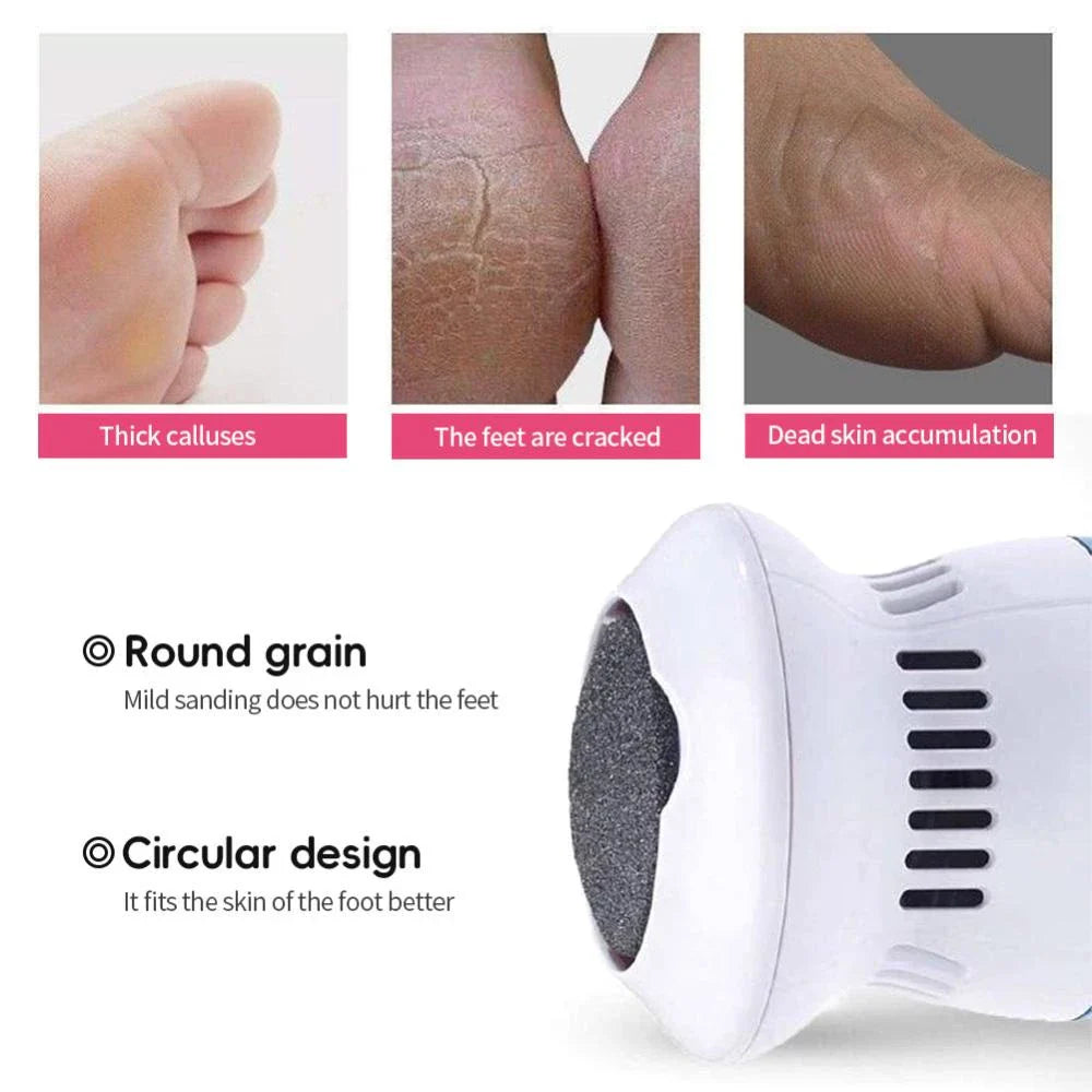The SmoothSole Foot Polisher - Professional Pedicure at Home + 50% OFF